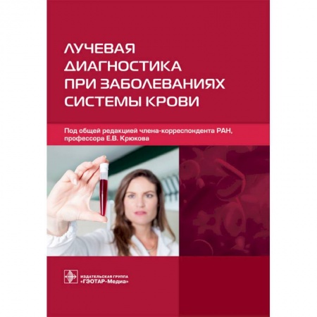 УЗИ. ЭКГ. Томография. Рентген, книга Лучевая диагностика при заболеваниях системы крови заказать