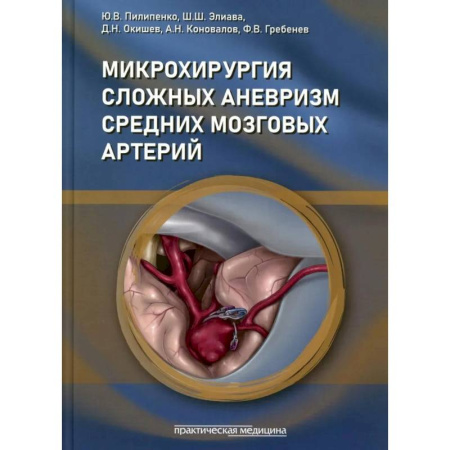 Хирургия. Ортопедия, книга Микрохирургия сложных аневризм средних мозговых артерий: гигантских, фузиформных и частично тромбированных заказать