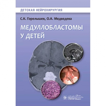 Хирургия. Ортопедия, книга Медуллобластомы у детей заказать