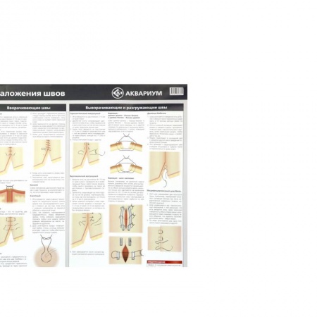Демонстрационные материалы, книга Плакат 'Техника наложения швов' 84х59 см. (в тубусе) заказать