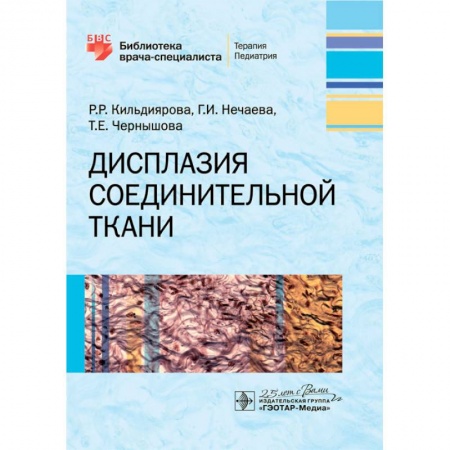 Медицина. Фармакология, книга Дисплазия соединительной ткани заказать