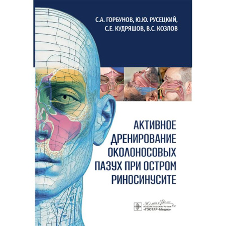 Медицинские энциклопедии и справочники, книга Активное дренирование околоносовых пазух при остром риносинусите заказать