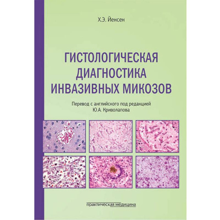Гистология. Эмбриология. Цитология, книга Гистологическая диагностика инвазивных микозов заказать