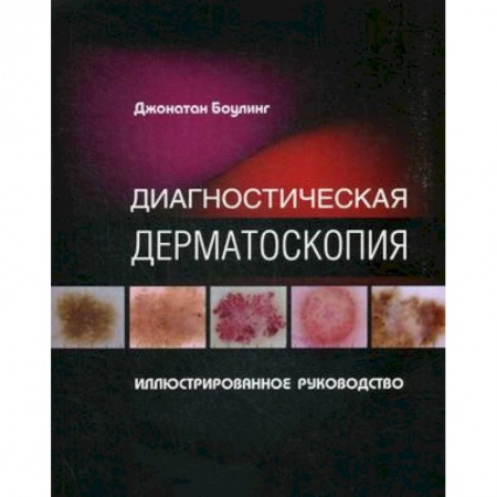 Кожные и венерические болезни, книга Диагностическая дерматоскопия. Иллюстрированное руководство заказать