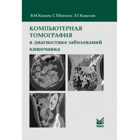 УЗИ. ЭКГ. Томография. Рентген, книга Компьютерная томография в диагностике заболеваний кишечника заказать