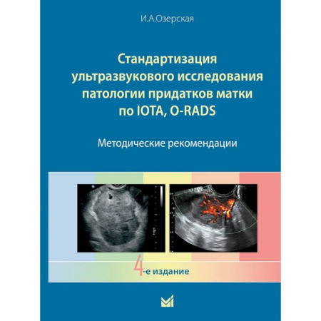 УЗИ. ЭКГ. Томография. Рентген, книга Стандартизация ультразвукового исследования патологии придатков матки по IOTA, O-RADS. Методические рекомендации. 4-е издание заказать