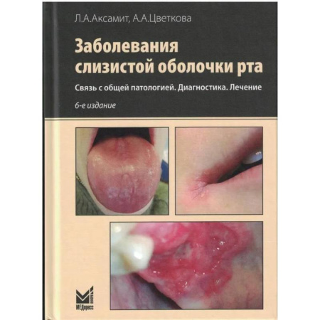 Медицинские энциклопедии и справочники, книга Заболевания слизистой оболочки рта. Связь с общей патологией. Диагностика. Лечение заказать