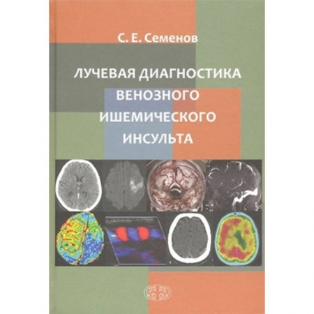 Кардиология, книга Лучевая диагностика венозного ишемического инсульта заказать