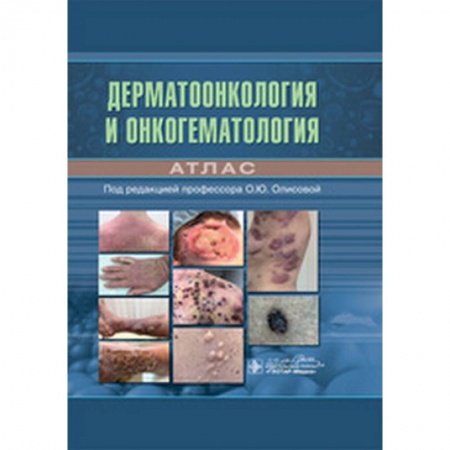 Кожные и венерические болезни, книга Дерматоонкология и онкогематология заказать