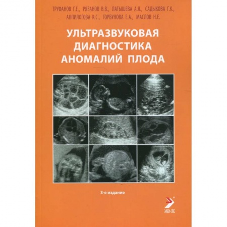 Акушерство и гинекология, книга Ультразвуковая диагностика аномалий плода: Руководство для врачей заказать