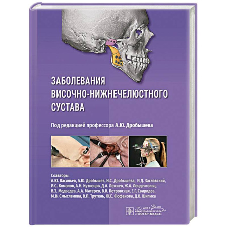 Медицинские энциклопедии и справочники, книга Заболевания височно-нижнечелюстного сустава заказать