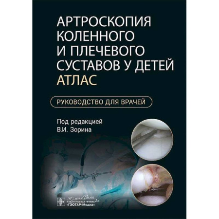 Хирургия. Ортопедия, книга Артроскопия коленного и плечевого суставов у детей. Атлас : руководство для врачей заказать