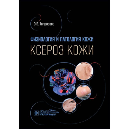 Кожные и венерические болезни, книга Физиология и патология кожи. Ксероз кожи заказать