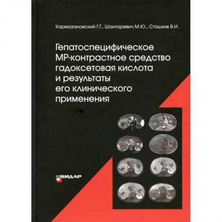Книги, книга Гепатоспецифическое МР-контрастное средство «гадоксетовая кислота» и результаты его клинического применения'. Кармазановский Г.Г., Шантаревич М.Ю., Сташкив В.И. заказать