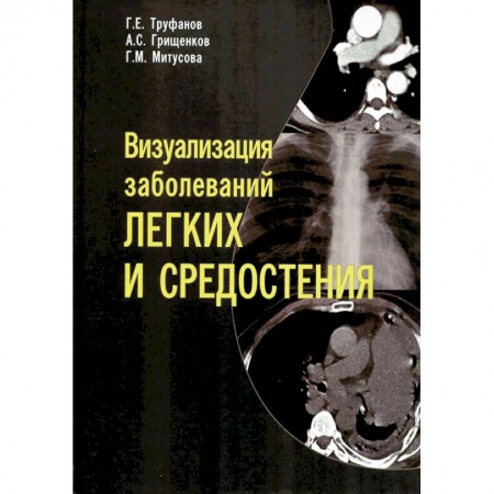 Органы дыхания. Туберкулез. Астма, книга Визуализация заболеваний легких и средостения заказать