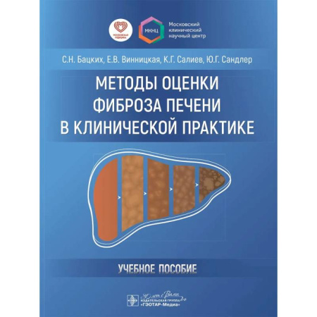Гастроэнтерология, книга Методы оценки фиброза печени в клинической практике заказать