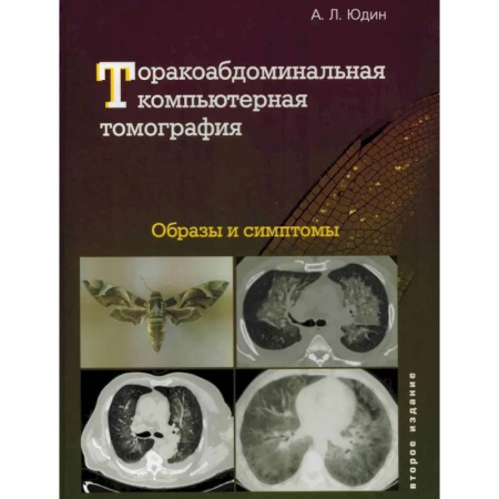 Специальная медицина, книга Торакоабдоминальная компьютерная томография. Образы и симптомы заказать