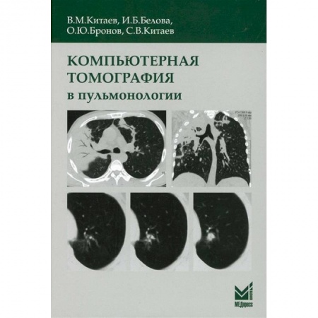 Другие виды специальной медицины, книга Компьютерная томография в пульмонологии заказать