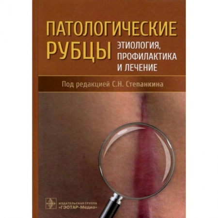 Хирургия. Ортопедия, книга Патологические рубцы. Этиология, профилактика и лечение заказать