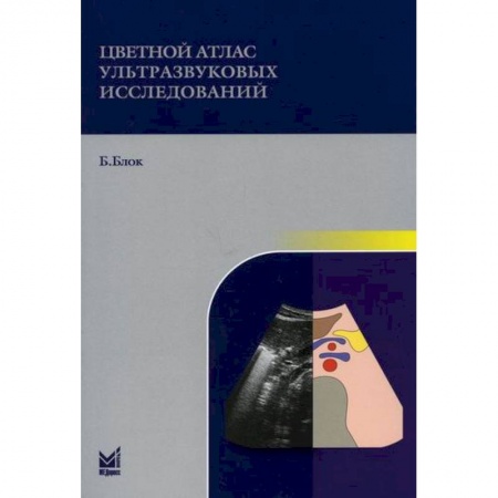УЗИ. ЭКГ. Томография. Рентген, книга Цветной атлас ультразвуковых исследований заказать