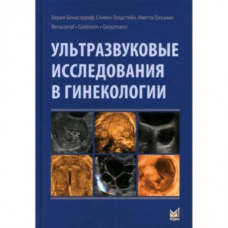 Акушерство и гинекология, книга Ультразвуковые исследования в гинекологии заказать