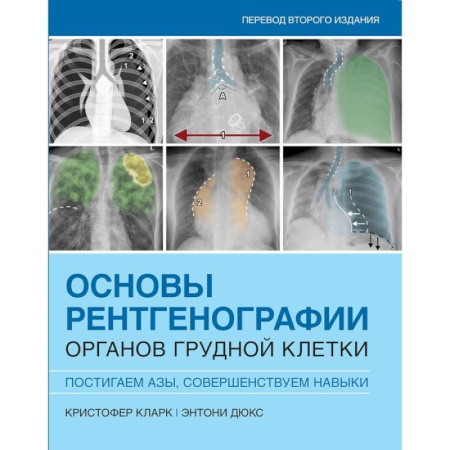 Другие виды специальной медицины, книга Основы рентгенографии органов грудной клетки заказать