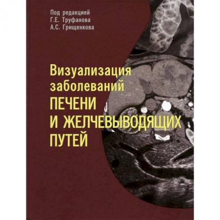 Гастроэнтерология, книга Визуализация заболевантй печени и желчевыводящих путей. Учебное пособие заказать