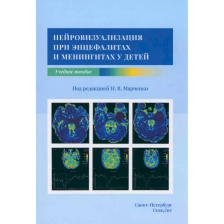 Отдельные виды заболеваний у детей, книга Нейровизуализация при энцефалитах и менингитах у детей заказать