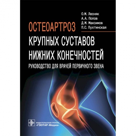 Книги, книга Остеоартроз крупных суставов нижних конечностей заказать