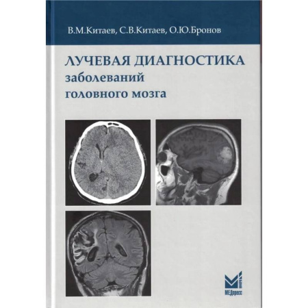 Другие виды специальной медицины, книга Лучевая диагностика заболеваний головного мозга заказать