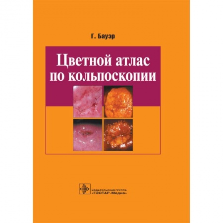 Акушерство и гинекология, книга Цветной атлас по кольпоскопии заказать