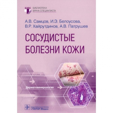 Медицина. Фармакология, книга Сосудистые болезни кожи заказать