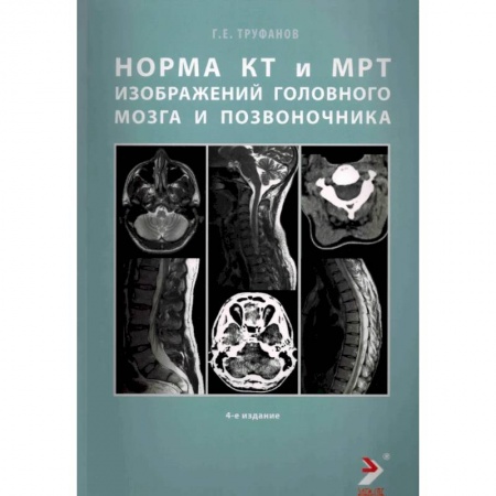 Другие виды специальной медицины, книга Норма КТ-и МРТ-изображений головного мозга и позвоночника заказать