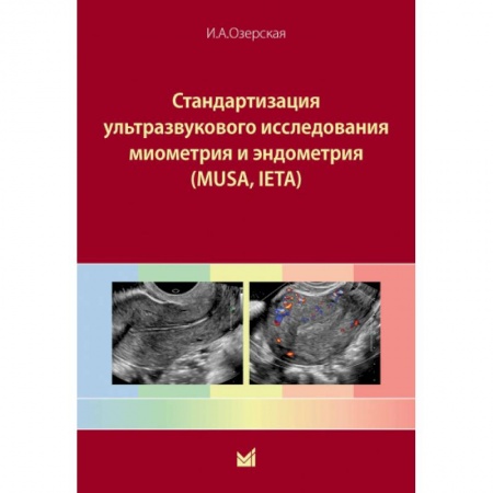 УЗИ. ЭКГ. Томография. Рентген, книга Стандартизация ультразвукового исследования миометрия и эндометрия (MUSA, IETA) заказать