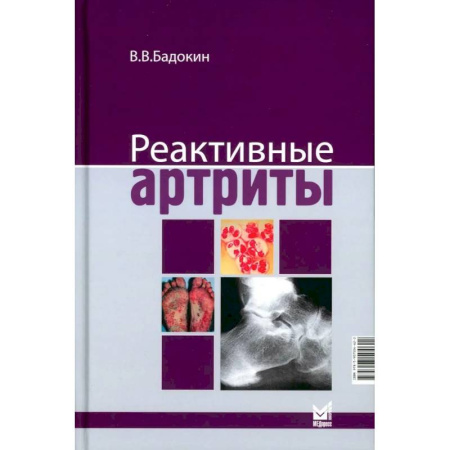 Медицинские энциклопедии и справочники, книга Реактивные артриты. Урогенитальные и постэнтероколитические заказать