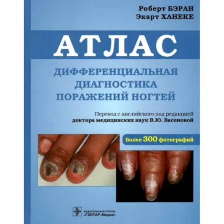Другие виды специальной медицины, книга Дифференциальная диагностика поражен ногтей. Атлас заказать