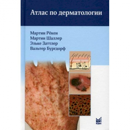 Кожные и венерические болезни, книга Атлас по дерматологии заказать