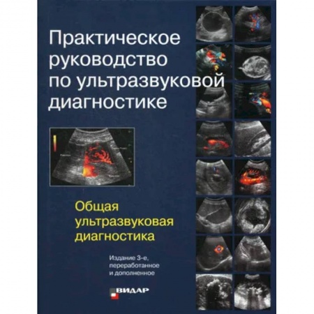 УЗИ. ЭКГ. Томография. Рентген, книга Практическое руководство по ультразвуковой диагностике. Общая ультразвуковая диагностика заказать