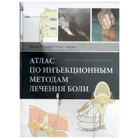 Онкология, книга Атлас по инъекционным методам лечения боли заказать