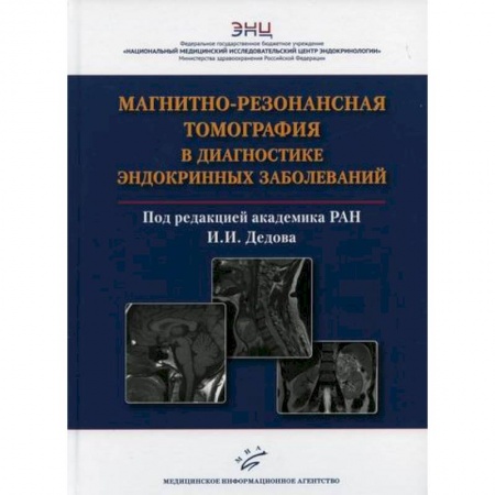 УЗИ. ЭКГ. Томография. Рентген, книга Магнитно-резонансная томография в диагностике эндокринных заболеваний заказать