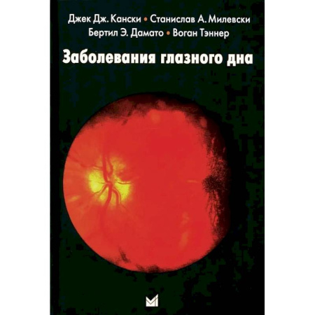Офтальмология, книга Заболевания глазного дна заказать