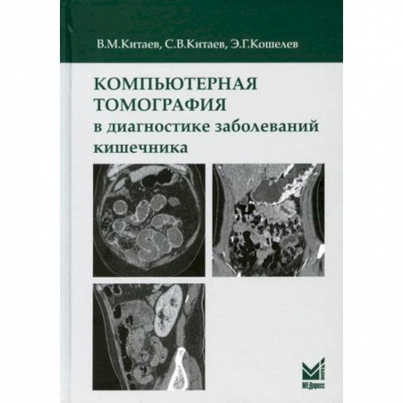УЗИ. ЭКГ. Томография. Рентген, книга Компьютерная томография в диагностике заболеваний кишечника заказать
