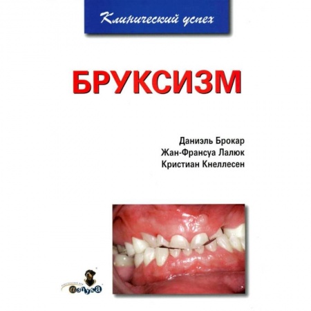 Стоматология, книга Бруксизм заказать