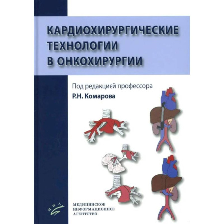 Онкология, книга Кардиохирургические технологии в онкохирургии заказать