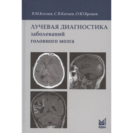 УЗИ. ЭКГ. Томография. Рентген, книга Лучевая диагностика заболеваний головного мозга заказать