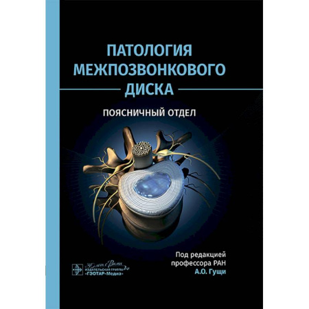 Здоровье, медицинская литература, книга Патология межпозвонкового диска. Поясничный отдел заказать