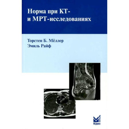 Другие виды специальной медицины, книга Норма при КТ- и МРТ-исследованиях заказать