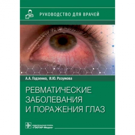 Книги, книга Ревматические заболевания и поражения глаз заказать