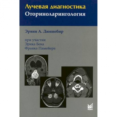 УЗИ. ЭКГ. Томография. Рентген, книга Лучевая диагностика. Оториноларингология заказать