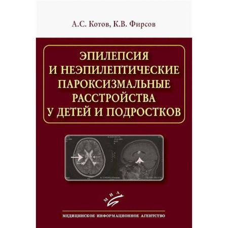 Другие виды специальной медицины, книга Эпилепсия и неэпилептические пароксизмальные расстройства у детей и подростков заказать